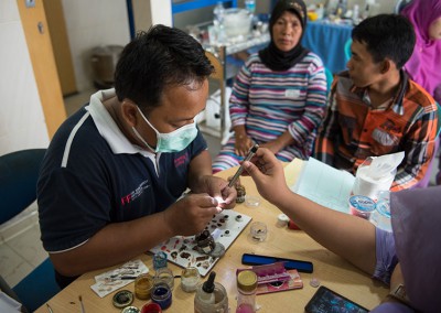 Prosthetic Eyes – The Gift Of Confidence