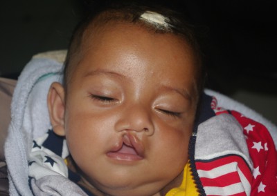 Children’s Corrective Surgery, Project 1