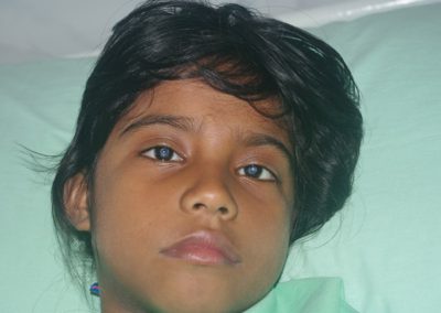 Children’s Cataract Surgery, Project 2