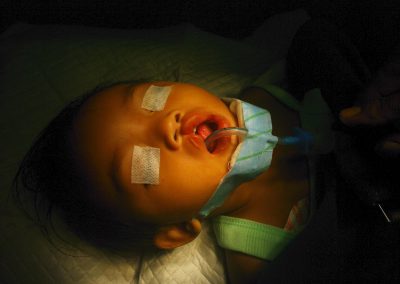 Children’s Corrective Surgery, Case 5