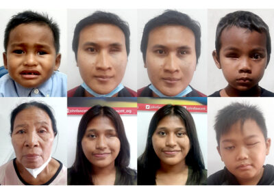 Prosthetic Eyes Project 8